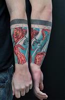 Mr. Lowerarm.